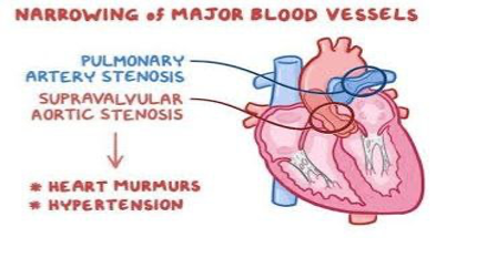 Cardiac Anomaly
